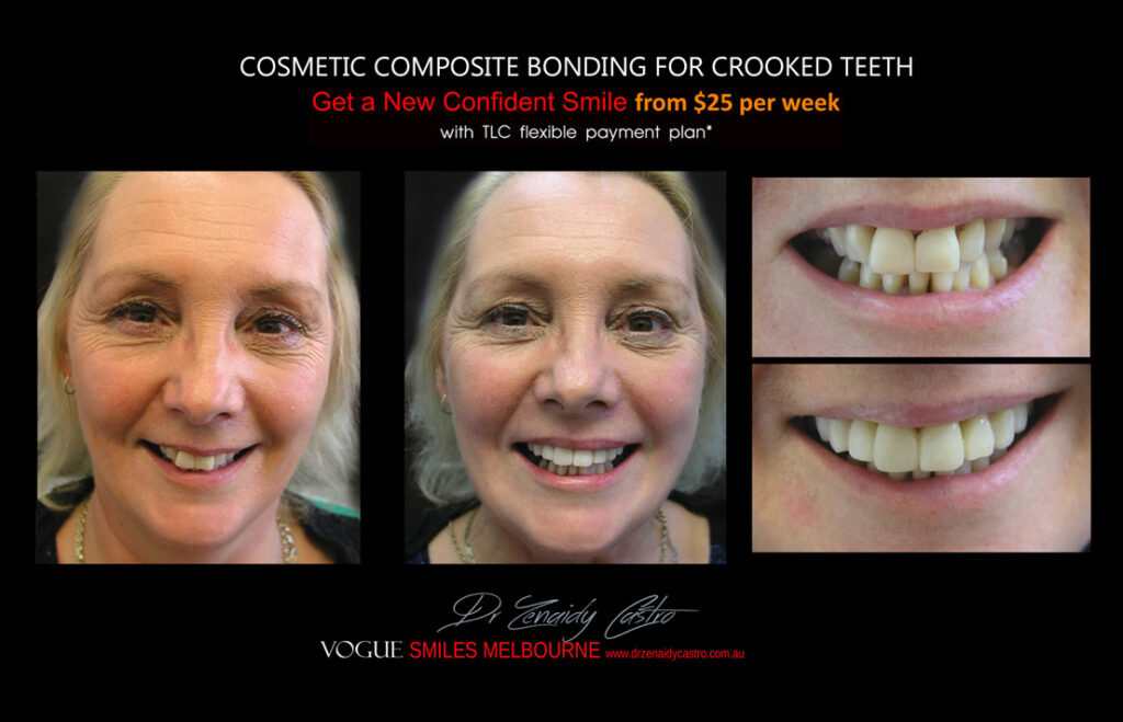 Vogue Smiles Melbourne - Vogue Dentist - Vogue Dental Melbourne -Best Cosmetic dentist in Melbourne CBD