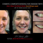 Vogue Smiles Melbourne - Vogue Dentist - Vogue Dental Melbourne -Best Cosmetic dentist in Melbourne CBD