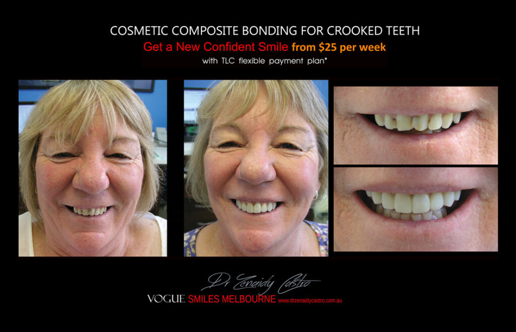 Vogue Smiles Melbourne - Vogue Dentist - Vogue Dental Melbourne -Best Cosmetic dentist in Melbourne CBD
