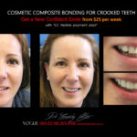 Vogue Smiles Melbourne - Vogue Dentist - Vogue Dental Melbourne -Best Cosmetic dentist in Melbourne CBD