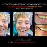 Vogue Smiles Melbourne - Vogue Dentist - Vogue Dental Melbourne -Best Cosmetic dentist in Melbourne CBD