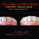 NARROW-SMILES-BROADENING-SMILES-MAKEOVERS-MELBOURNE-14.jpg