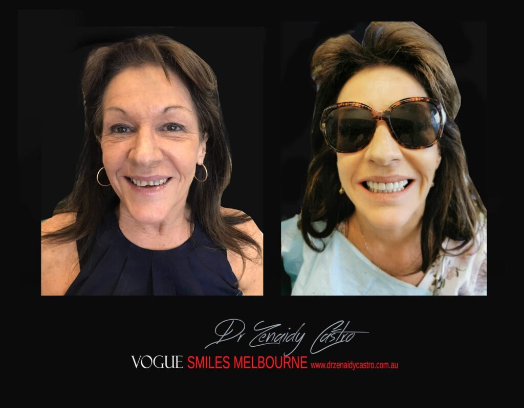 Vogue Smiles Melbourne - Vogue Dentist - Vogue Dental Melbourne -Best Cosmetic dentist in Melbourne CBD