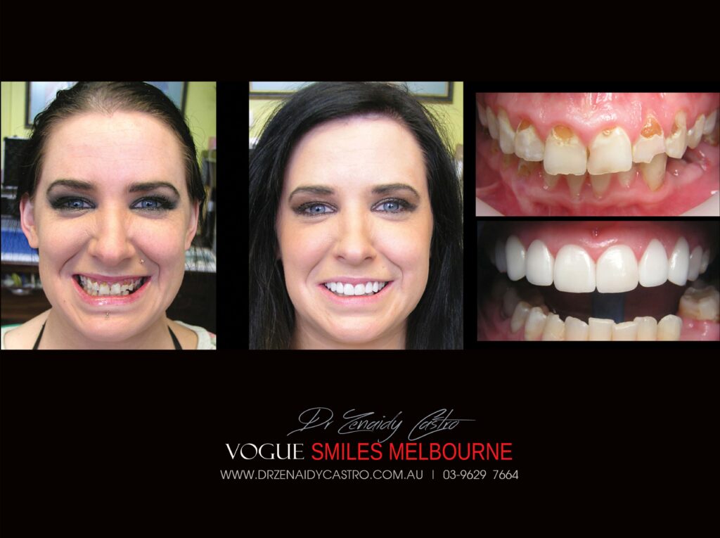 Vogue Smiles Melbourne - Vogue Dentist - Vogue Dental Melbourne -Best Cosmetic dentist in Melbourne CBD