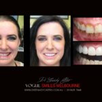 Vogue Smiles Melbourne - Vogue Dentist - Vogue Dental Melbourne -Best Cosmetic dentist in Melbourne CBD