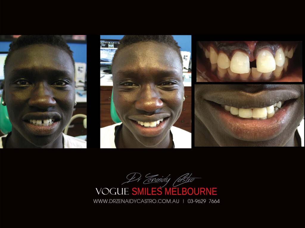 Vogue Smiles Melbourne - Vogue Dentist - Vogue Dental Melbourne -Best Cosmetic dentist in Melbourne CBD