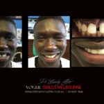 Vogue Smiles Melbourne - Vogue Dentist - Vogue Dental Melbourne -Best Cosmetic dentist in Melbourne CBD