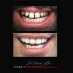 VOGUE-SMILES-COSMETIC-DENTISTRY-TREATMENT-127-scaled.jpg