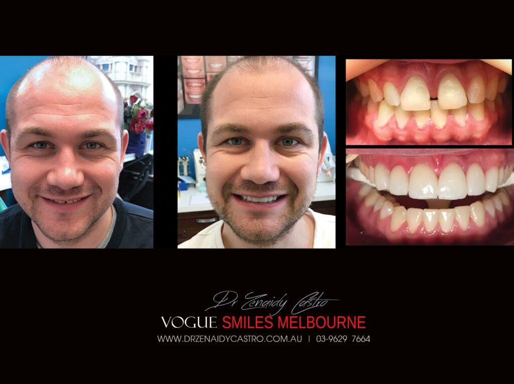 Vogue Smiles Melbourne - Vogue Dentist - Vogue Dental Melbourne -Best Cosmetic dentist in Melbourne CBD
