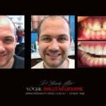 Vogue Smiles Melbourne - Vogue Dentist - Vogue Dental Melbourne -Best Cosmetic dentist in Melbourne CBD