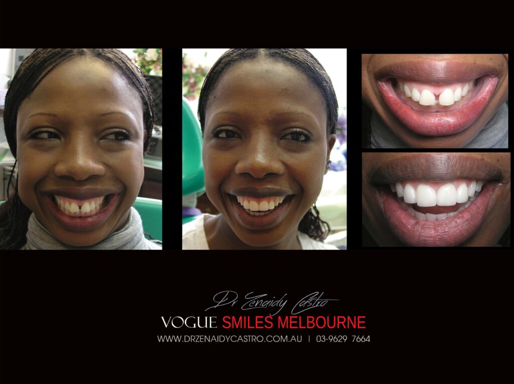 Vogue Smiles Melbourne - Vogue Dentist - Vogue Dental Melbourne -Best Cosmetic dentist in Melbourne CBD