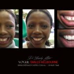 Vogue Smiles Melbourne - Vogue Dentist - Vogue Dental Melbourne -Best Cosmetic dentist in Melbourne CBD