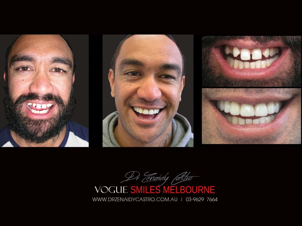 Vogue Smiles Melbourne - Vogue Dentist - Vogue Dental Melbourne -Best Cosmetic dentist in Melbourne CBD