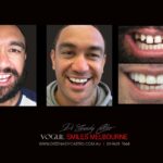 VOGUE-SMILES-COSMETIC-DENTISTRY-TREATMENT-15-scaled.jpg