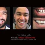 Vogue Smiles Melbourne - Vogue Dentist - Vogue Dental Melbourne -Best Cosmetic dentist in Melbourne CBD