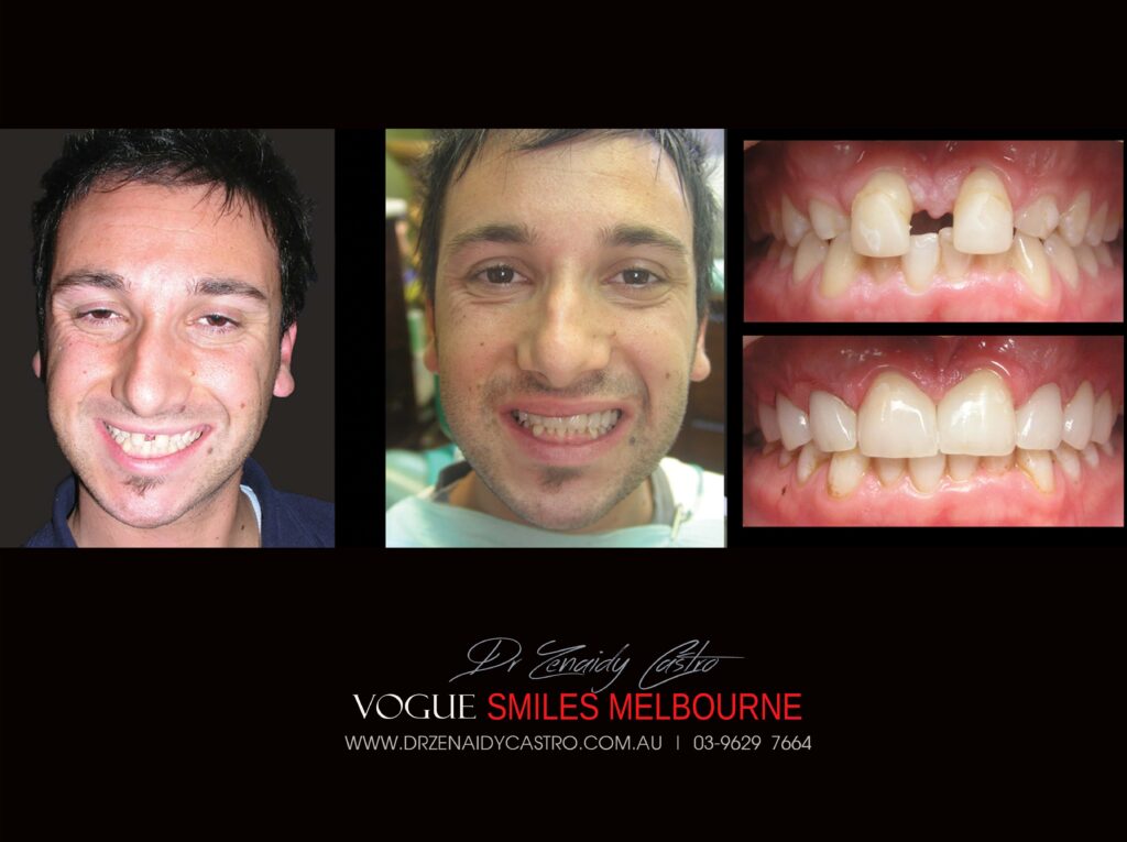 Vogue Smiles Melbourne - Vogue Dentist - Vogue Dental Melbourne -Best Cosmetic dentist in Melbourne CBD