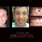 Vogue Smiles Melbourne - Vogue Dentist - Vogue Dental Melbourne -Best Cosmetic dentist in Melbourne CBD