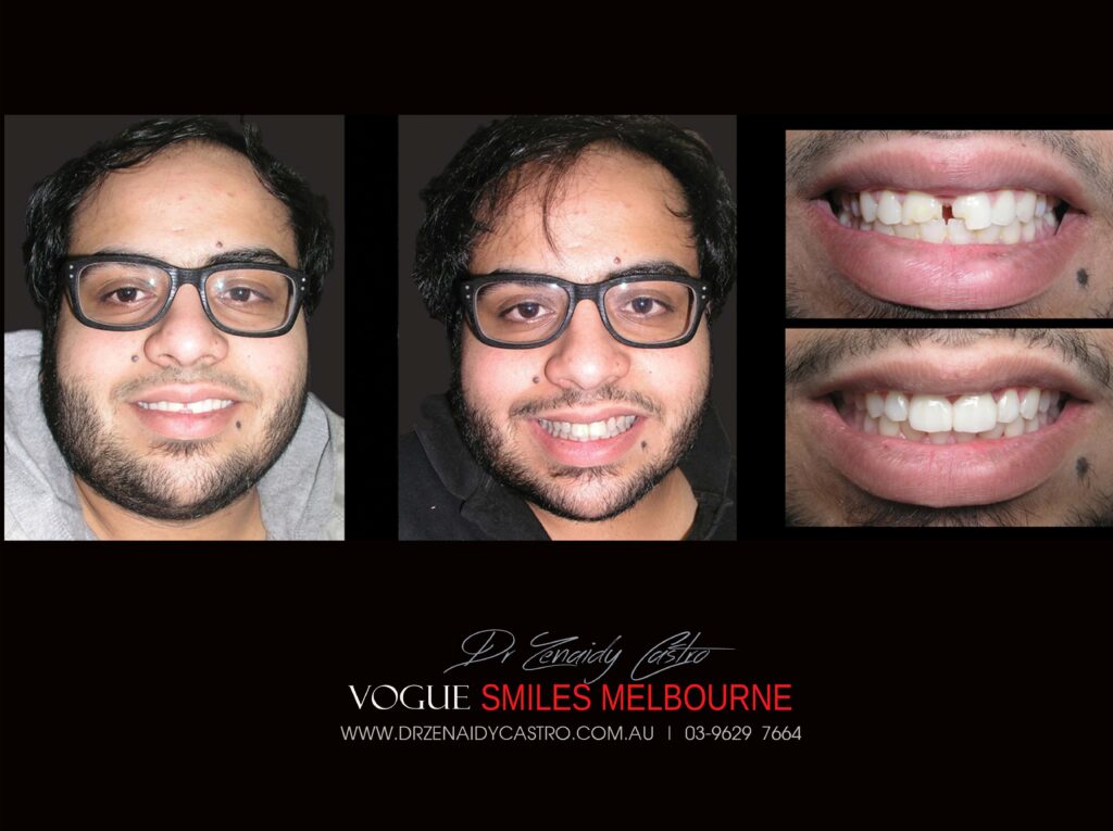 Vogue Smiles Melbourne - Vogue Dentist - Vogue Dental Melbourne -Best Cosmetic dentist in Melbourne CBD