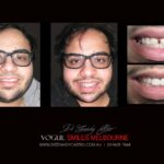 Vogue Smiles Melbourne - Vogue Dentist - Vogue Dental Melbourne -Best Cosmetic dentist in Melbourne CBD