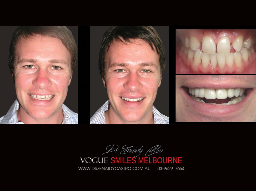 Vogue Smiles Melbourne - Vogue Dentist - Vogue Dental Melbourne -Best Cosmetic dentist in Melbourne CBD