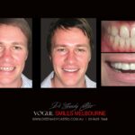 Vogue Smiles Melbourne - Vogue Dentist - Vogue Dental Melbourne -Best Cosmetic dentist in Melbourne CBD