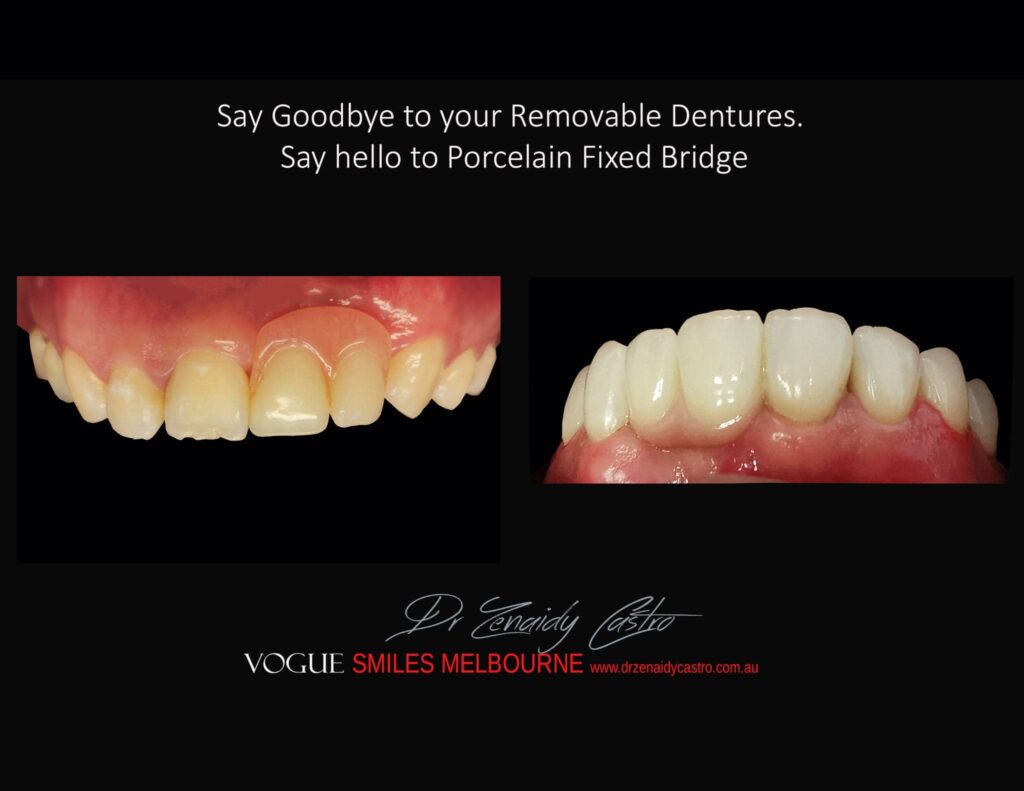 VOGUE-SMILES-COSMETIC-DENTISTRY-TREATMENT-182.jpg