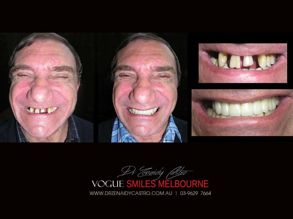 Vogue Smiles Melbourne - Vogue Dentist - Vogue Dental Melbourne -Best Cosmetic dentist in Melbourne CBD