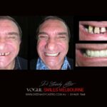 Vogue Smiles Melbourne - Vogue Dentist - Vogue Dental Melbourne -Best Cosmetic dentist in Melbourne CBD