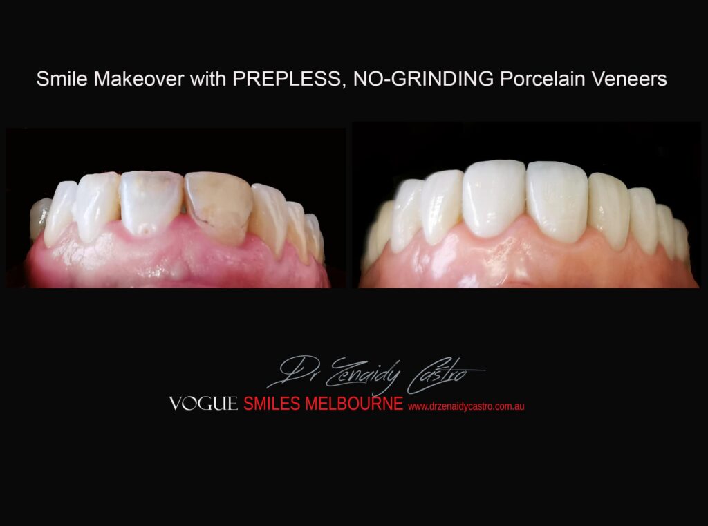 Vogue Smiles Melbourne - Vogue Dentist - Vogue Dental Melbourne -Best Cosmetic dentist in Melbourne CBD