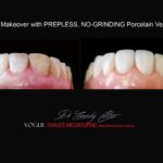 Vogue Smiles Melbourne - Vogue Dentist - Vogue Dental Melbourne -Best Cosmetic dentist in Melbourne CBD