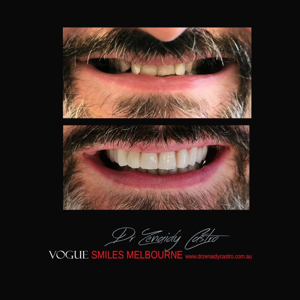 VOGUE-SMILES-COSMETIC-DENTISTRY-TREATMENT-195.jpg