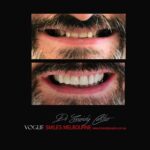 VOGUE-SMILES-COSMETIC-DENTISTRY-TREATMENT-195.jpg