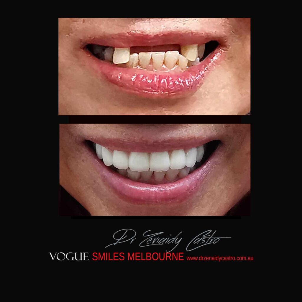 Vogue Smiles Melbourne - Vogue Dentist - Vogue Dental Melbourne -Best Cosmetic dentist in Melbourne CBD