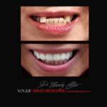 Vogue Smiles Melbourne - Vogue Dentist - Vogue Dental Melbourne -Best Cosmetic dentist in Melbourne CBD