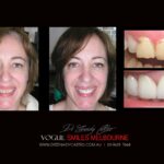 Vogue Smiles Melbourne - Vogue Dentist - Vogue Dental Melbourne -Best Cosmetic dentist in Melbourne CBD