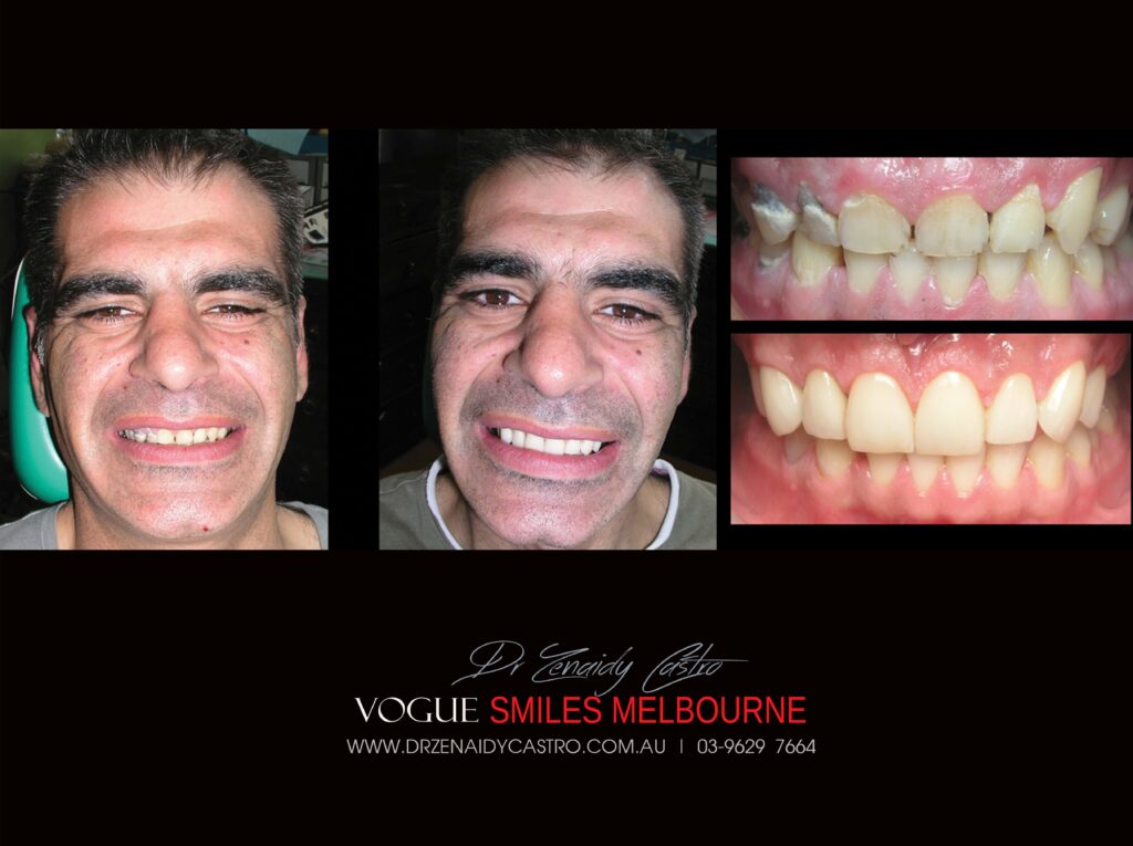 Vogue Smiles Melbourne - Vogue Dentist - Vogue Dental Melbourne -Best Cosmetic dentist in Melbourne CBD
