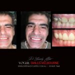 Vogue Smiles Melbourne - Vogue Dentist - Vogue Dental Melbourne -Best Cosmetic dentist in Melbourne CBD