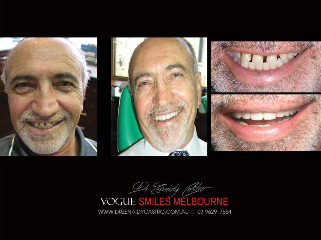 Vogue Smiles Melbourne - Vogue Dentist - Vogue Dental Melbourne -Best Cosmetic dentist in Melbourne CBD