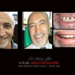 Vogue Smiles Melbourne - Vogue Dentist - Vogue Dental Melbourne -Best Cosmetic dentist in Melbourne CBD