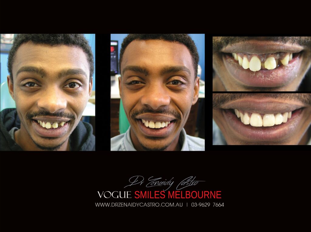 Vogue Smiles Melbourne - Vogue Dentist - Vogue Dental Melbourne -Best Cosmetic dentist in Melbourne CBD