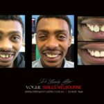 Vogue Smiles Melbourne - Vogue Dentist - Vogue Dental Melbourne -Best Cosmetic dentist in Melbourne CBD