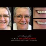 Vogue Smiles Melbourne - Vogue Dentist - Vogue Dental Melbourne -Best Cosmetic dentist in Melbourne CBD