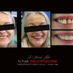 Vogue Smiles Melbourne - Vogue Dentist - Vogue Dental Melbourne -Best Cosmetic dentist in Melbourne CBD