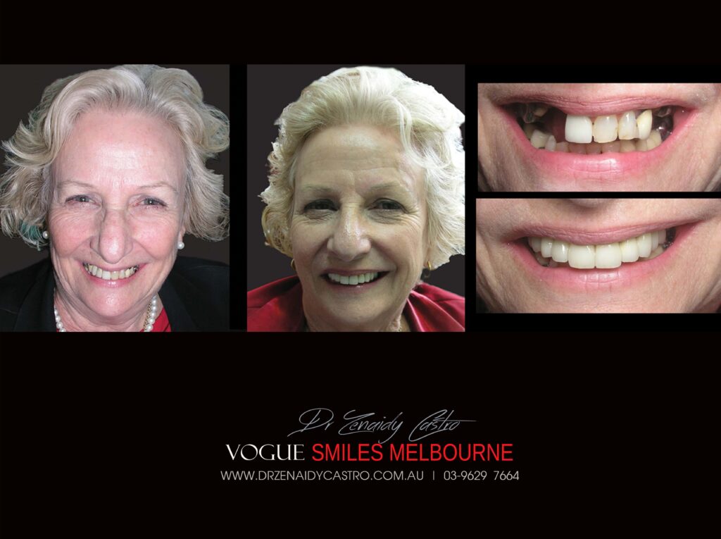 Vogue Smiles Melbourne - Vogue Dentist - Vogue Dental Melbourne -Best Cosmetic dentist in Melbourne CBD