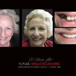 Vogue Smiles Melbourne - Vogue Dentist - Vogue Dental Melbourne -Best Cosmetic dentist in Melbourne CBD