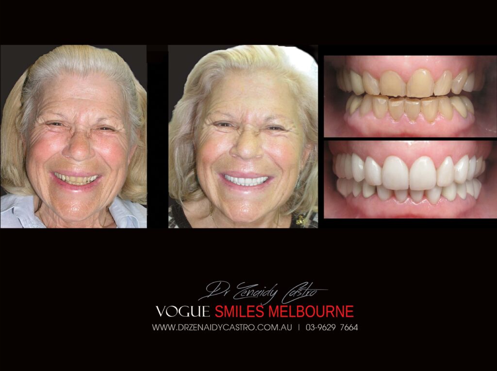 Vogue Smiles Melbourne - Vogue Dentist - Vogue Dental Melbourne -Best Cosmetic dentist in Melbourne CBD