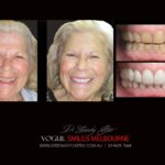 VOGUE-SMILES-COSMETIC-DENTISTRY-TREATMENT-25-scaled.jpg