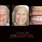 Vogue Smiles Melbourne - Vogue Dentist - Vogue Dental Melbourne -Best Cosmetic dentist in Melbourne CBD