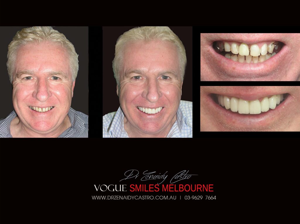 Vogue Smiles Melbourne - Vogue Dentist - Vogue Dental Melbourne -Best Cosmetic dentist in Melbourne CBD