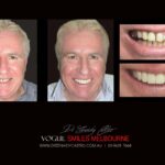 Vogue Smiles Melbourne - Vogue Dentist - Vogue Dental Melbourne -Best Cosmetic dentist in Melbourne CBD